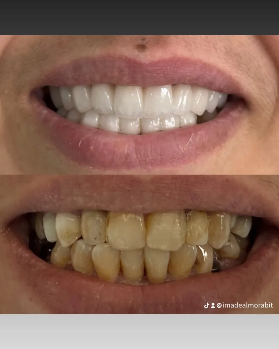 Cas réels · Hollywood Smile